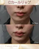 Cカールリップ after画像 サムネイル用
