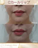 Cカールリップ after画像 サムネイル用