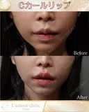 Cカールリップ after画像 サムネイル用