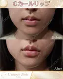 Cカールリップ after画像 サムネイル用