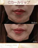Cカールリップ after画像 サムネイル用