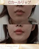 Cカールリップ after画像 サムネイル用