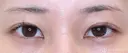 【20代女性・目頭側の重さ解消】目上切開（1ヶ月後） before画像 サムネイル用