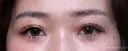 【20代女性・眠そうな目元】眼瞼下垂埋没法（直後・2ヶ月後） 60日後 サムネイル用