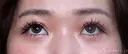 【20代女性・眠そうな目元】眼瞼下垂埋没法（直後・2ヶ月後） 60日後 サムネイル用