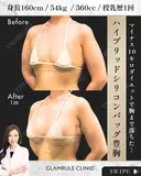 ハイブリッド豊胸 before画像 サムネイル用