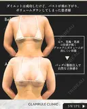 ハイブリッド豊胸 30日後 サムネイル用