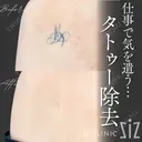 【タトゥー除去】仕事で気を遣う… after画像 サムネイル用