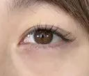 アリエルクイックループ（二重埋没法） before画像 サムネイル用