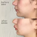 Cカールリップ💋✨ before画像 サムネイル用