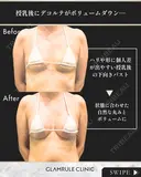 シリコンバッグ豊胸 30日後 サムネイル用