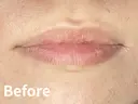 リップアートメイク before画像 サムネイル用