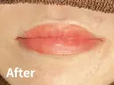 リップアートメイク after画像 サムネイル用