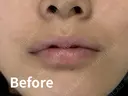 リップアートメイク before画像 サムネイル用