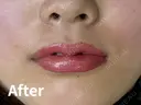 リップアートメイク after画像 サムネイル用