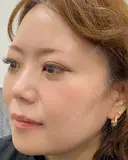 韓国式手彫りパウダー眉 before画像 サムネイル用