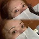 眉毛アートメイク before画像 サムネイル用