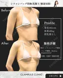 シリコンバッグ豊胸 30日後 サムネイル用