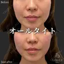 オールタイト after画像 サムネイル用