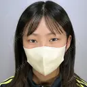 【学割】BELINDAバレにくい二重埋没｜3年保証付｜韓流・末広・平行など豊富なデザインから選べる💖 before画像 サムネイル用