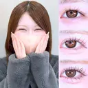 アリエルクイックループトリプル二重埋没法/瞼の上の脂肪取り 90日後 サムネイル用