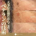顔・身体OK３個20,000円！年間10万個ホクロ・イボ除去Dr在籍🐰当院人気No１治療✨ after画像 サムネイル用