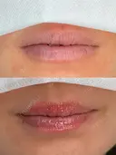 リップアートメイク before画像 サムネイル用