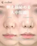 人中短縮 after画像 サムネイル用