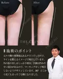 内ももに隙間出現！｜太ももの360°脂肪吸引 after画像 サムネイル用