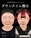山本の🎀脂肪吸引🎀 after画像 サムネイル用