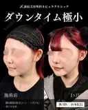 山本の🎀脂肪吸引🎀 before画像 サムネイル用