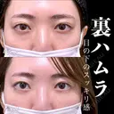 裏ハムラ 7日後 サムネイル用