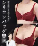 シリコンバッグ豊胸 90日後 サムネイル用