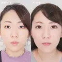 埋没法ダブル before画像 サムネイル用