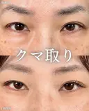 山本の🎀クマ取り🎀 after画像 サムネイル用