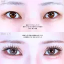 アリエルクイックループトリプル二重埋没法 before画像 サムネイル用