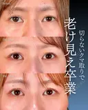岩﨑先生による🔥クマ取り🔥 before画像 サムネイル用