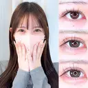 アリエルクイックループダブル二重埋没法/瞼の上の脂肪取り/涙袋ヒアルロン酸 after画像 サムネイル用