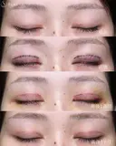 【20代女性・二重切開で綺麗な平行二重に】二重切開（1ヶ月後） 30日後 サムネイル用