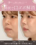 出っ歯🐰口元の膨らみ🎈上下セットバック 90日後 サムネイル用