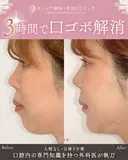 出っ歯🐰口元の膨らみ🎈上下セットバック before画像 サムネイル用