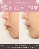 出っ歯🐰口元の膨らみ🎈上下セットバック 180日後 サムネイル用