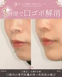 出っ歯🐰口元の膨らみ🎈上下セットバック 180日後 サムネイル用