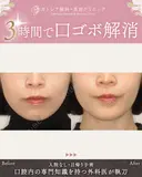 出っ歯🐰口元の膨らみ🎈上下セットバック 180日後 サムネイル用