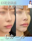 Cカールリップ after画像 サムネイル用