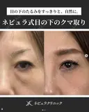 ⭐Dr都築⭐くま取り after画像 サムネイル用