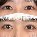 【🖼️YBC式クイックアイ🖼️】 before画像 サムネイル用