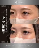 裏ハムラ after画像 サムネイル用