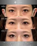 裏ハムラ before画像 サムネイル用