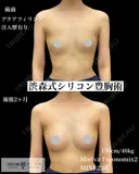 【アクアフィリング注入歴あり】ナチュラルにサイズアップ💝 after画像 サムネイル用